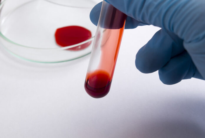 Live Blood Analysis Melbourne